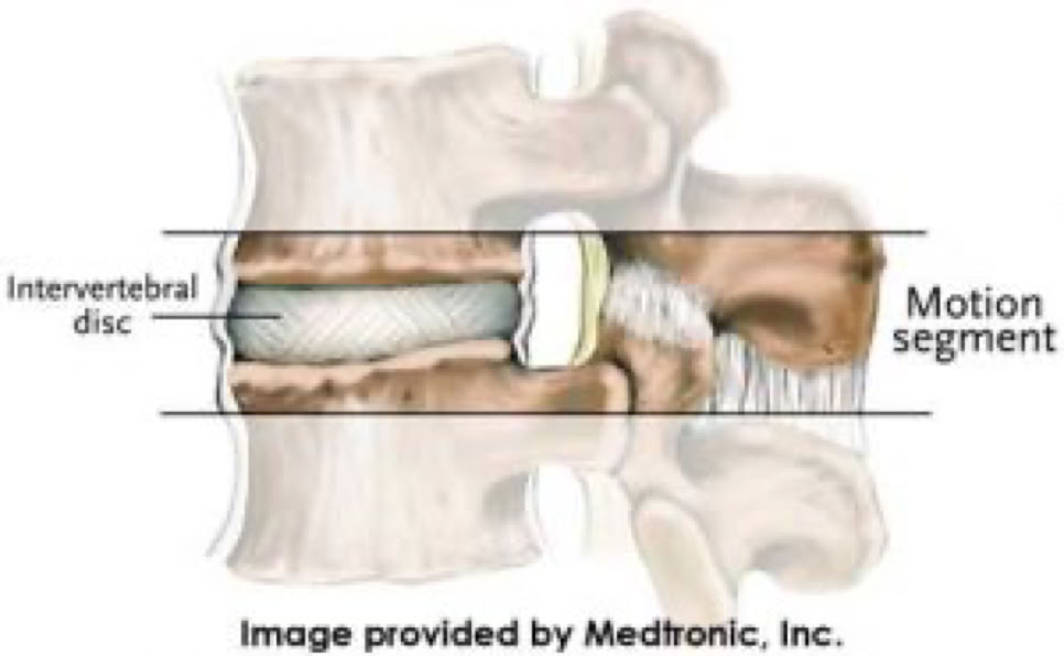 normal motion segment